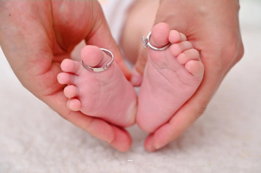 郴州孕妇怎样预防妊娠纹